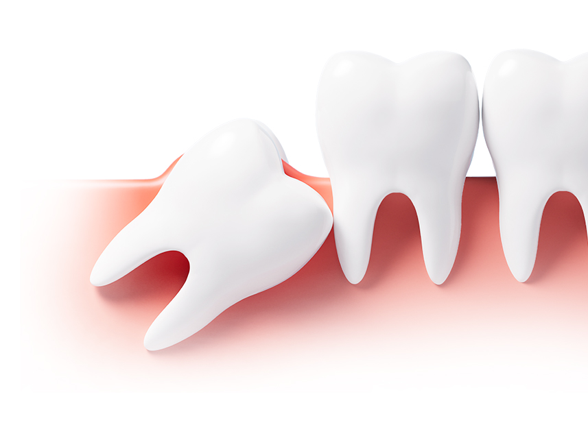 datalCare06_con01_01